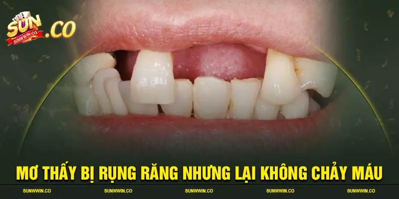 Mơ thấy bị rụng răng nhưng lại không chảy máu