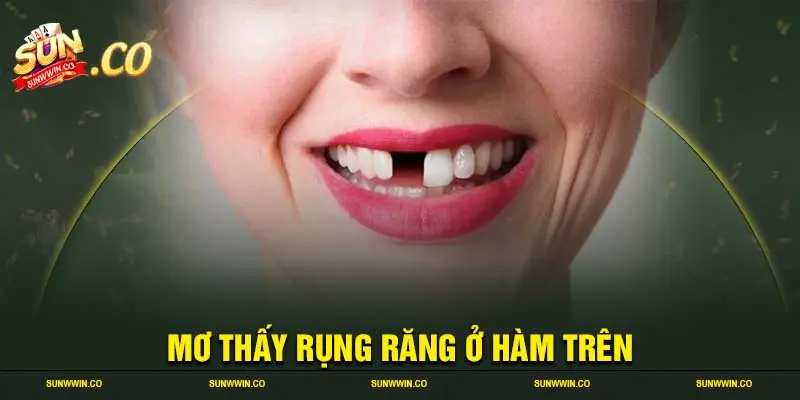 Mơ thấy rụng răng ở hàm trên